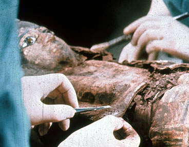 Unwrapping Mummy 1770
